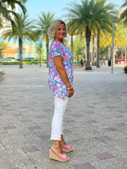 JELLY FISH SHORT SLEEVE TOP